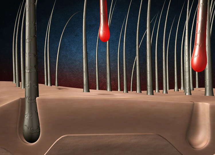 Nang tóc là thành phần chính cấu tạo nên sợi tóc Nang tóc là thành phần chính cấu tạo nên sợi tóc