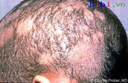 2.Điều kiện y tế 1 2.Điều kiện y tế 1