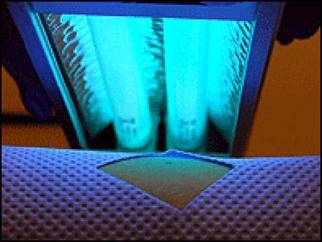 Các phương pháp điều trị bệnh trụng tóc 2 Các phương pháp điều trị bệnh trụng tóc 2