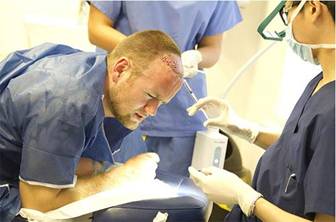 c. Cấy T óc nhân tạo 1 c. Cấy T óc nhân tạo 1