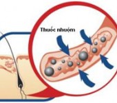 Thuốc nhuộm tóc độc hại như thế nào? 1 Thuốc nhuộm tóc độc hại như thế nào? 1