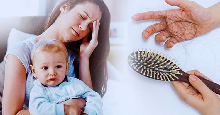 Rụng tóc sau sinh là bệnh gì? Rụng tóc sau sinh là bệnh gì?