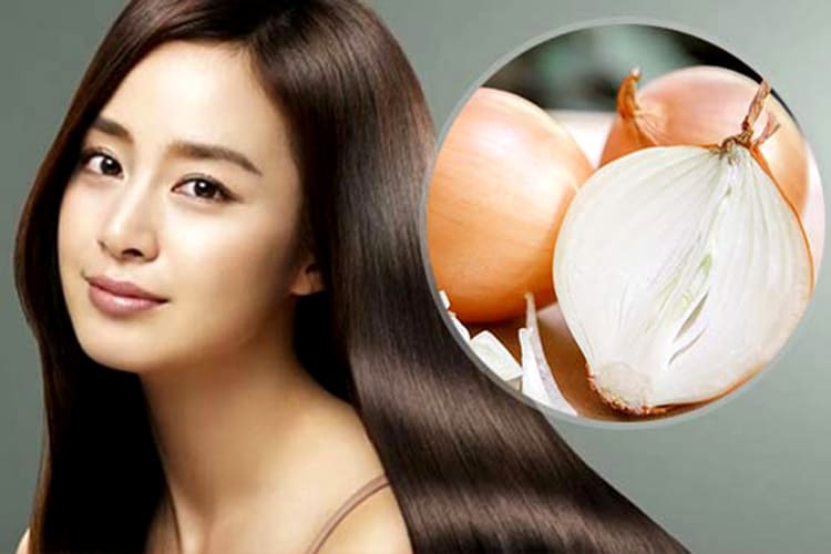 Hành tây giúp tóc mọc nhanh và dày Hành tây giúp tóc mọc nhanh và dày