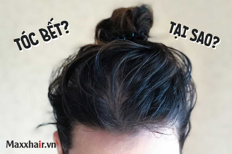 Vì sao bạn bị tóc dầu ? 1 Vì sao bạn bị tóc dầu ? 1