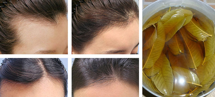 Lá ổi có công dụng rất tốt trong việc cải thiện tình trạng tóc gãy rụng Lá ổi có công dụng rất tốt trong việc cải thiện tình trạng tóc gãy rụng