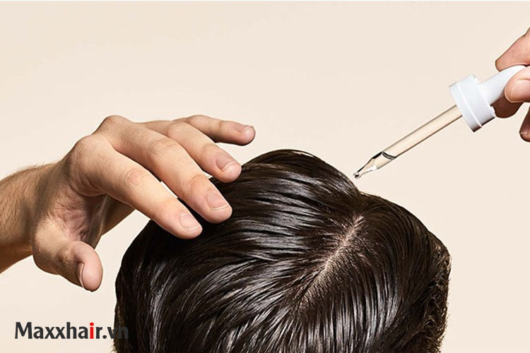 Thuốc mọc tóc là gì? 1 Thuốc mọc tóc là gì? 1