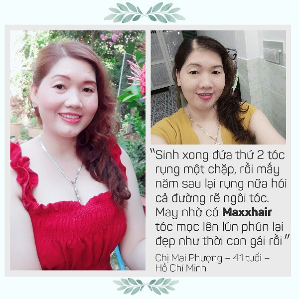 Khách hàng nói gì về Maxxhair? 1 Khách hàng nói gì về Maxxhair? 1