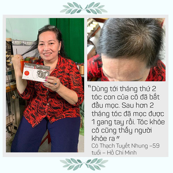 Khách hàng chia sẻ về Maxxhair? 5