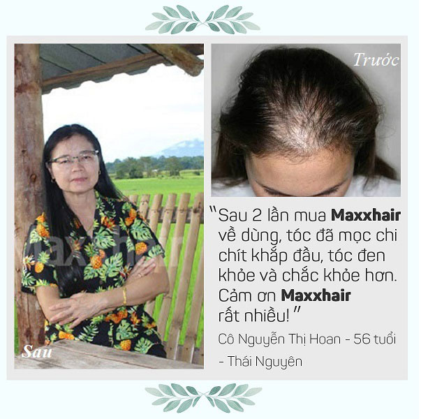 Khách hàng nói gì về Maxxhair? 1 Khách hàng nói gì về Maxxhair? 1