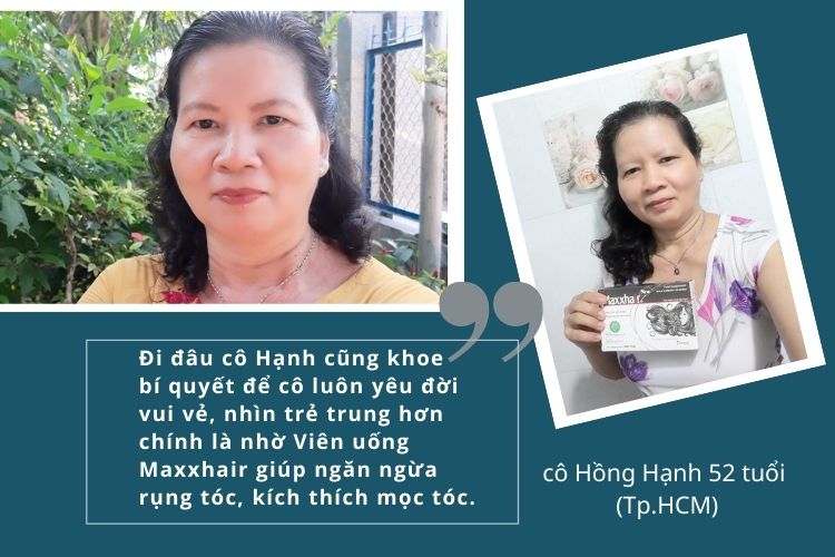 Viên uống Maxxhair - Giải pháp cải thiện hói đầu từ bên trong 2 Viên uống Maxxhair - Giải pháp cải thiện hói đầu từ bên trong 2