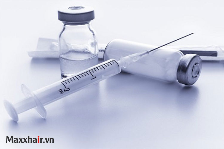 Tiêm Corticosteroid điều trị rụng tóc hình đồng xu 1 Tiêm Corticosteroid điều trị rụng tóc hình đồng xu 1