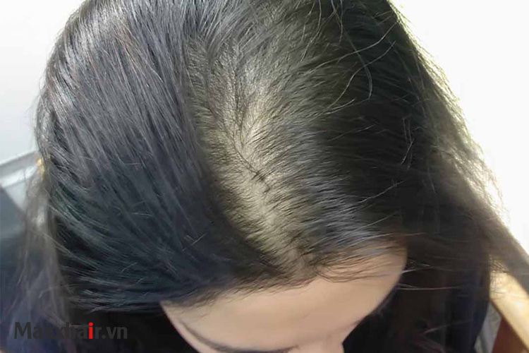 Androgen 1 Androgen 1