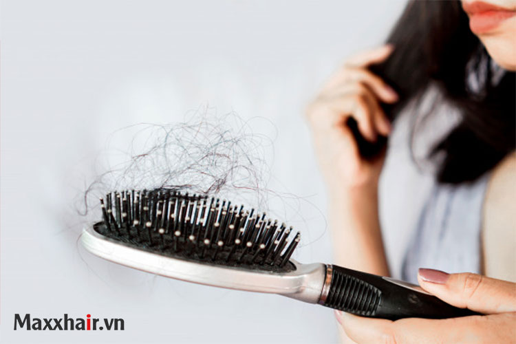 Biểu hiện bệnh rụng tóc toàn thể 1 Biểu hiện bệnh rụng tóc toàn thể 1