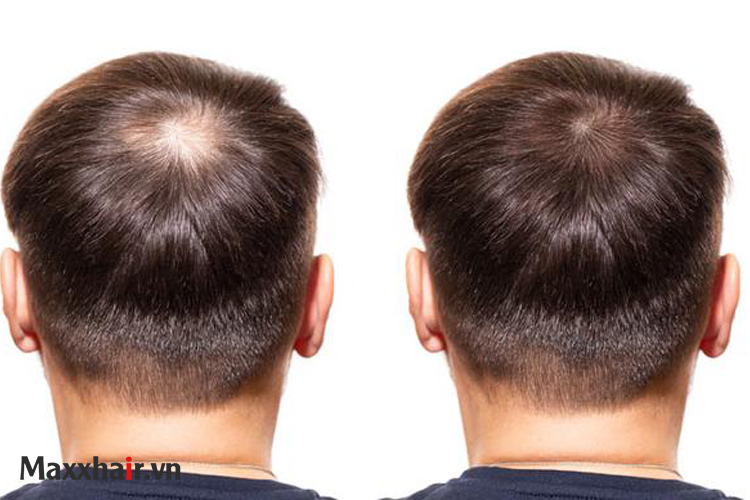 Nội tiết tố sinh dục 1 Nội tiết tố sinh dục 1