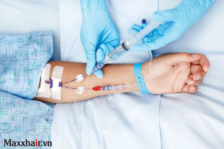 Mối liên hệ giữa rụng tóc và bệnh ung thư 1 Mối liên hệ giữa rụng tóc và bệnh ung thư 1