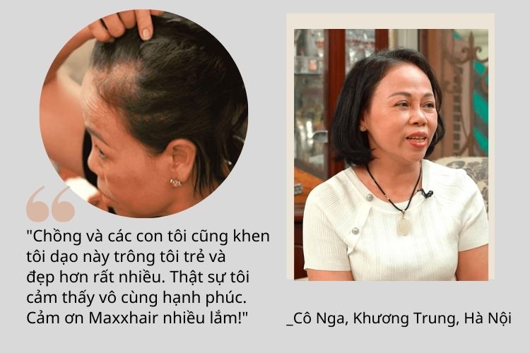 Viên uống Maxxhair - Giải pháp cải thiện hói đầu từ bên trong 4 Viên uống Maxxhair - Giải pháp cải thiện hói đầu từ bên trong 4