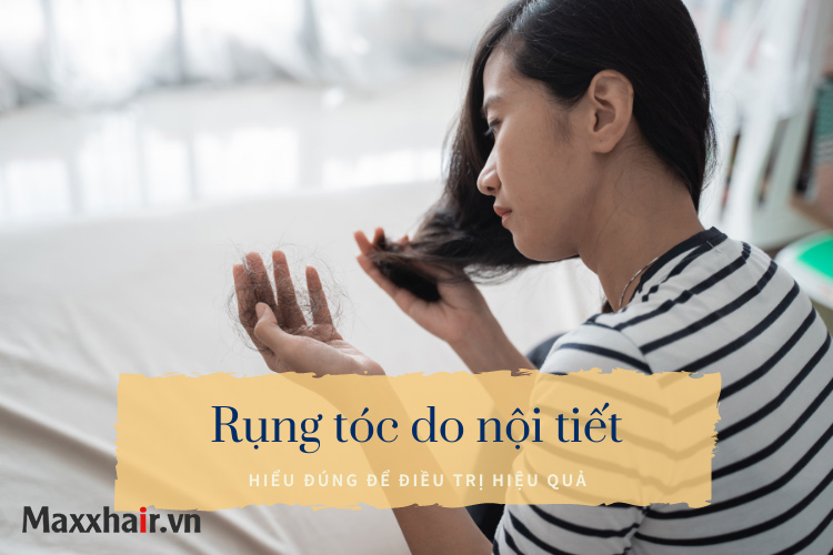 Rụng tóc do nội tiết: Hiểu đúng để điều trị hiệu quả 1 Rụng tóc do nội tiết: Hiểu đúng để điều trị hiệu quả 1