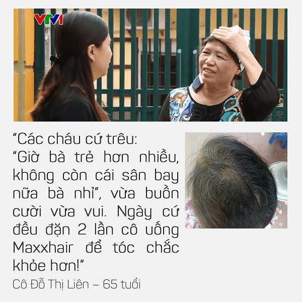 Tại sao nên chọn Maxxhair khi bị Rụng tóc nhiều, Hói đầu sớm? 6 Tại sao nên chọn Maxxhair khi bị Rụng tóc nhiều, Hói đầu sớm? 6