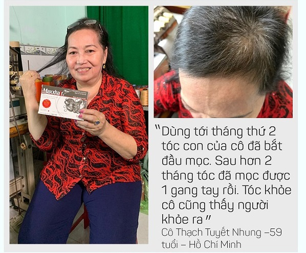 Khách hàng chia sẻ về Maxxhair? 5 Khách hàng chia sẻ về Maxxhair? 5