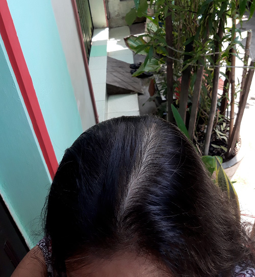 Tìm lại mái tóc thanh xuân 2 Tìm lại mái tóc thanh xuân 2