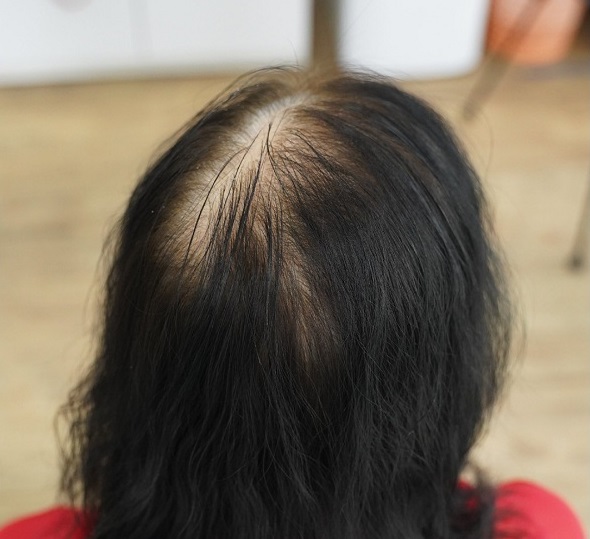 Mất ăn mất ngủ vì Mất ăn mất ngủ vì