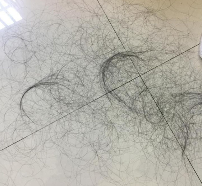 Không dám gội đầu nhiều vì tóc rụng như trút 1 Không dám gội đầu nhiều vì tóc rụng như trút 1