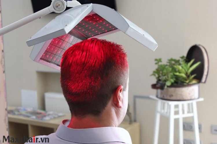 Laser năng lượng thấp (LLLT) 1 Laser năng lượng thấp (LLLT) 1