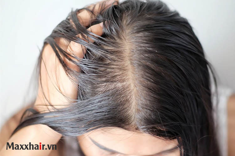 Sự thay đổi của mái tóc và da đầu khi Sự thay đổi của mái tóc và da đầu khi