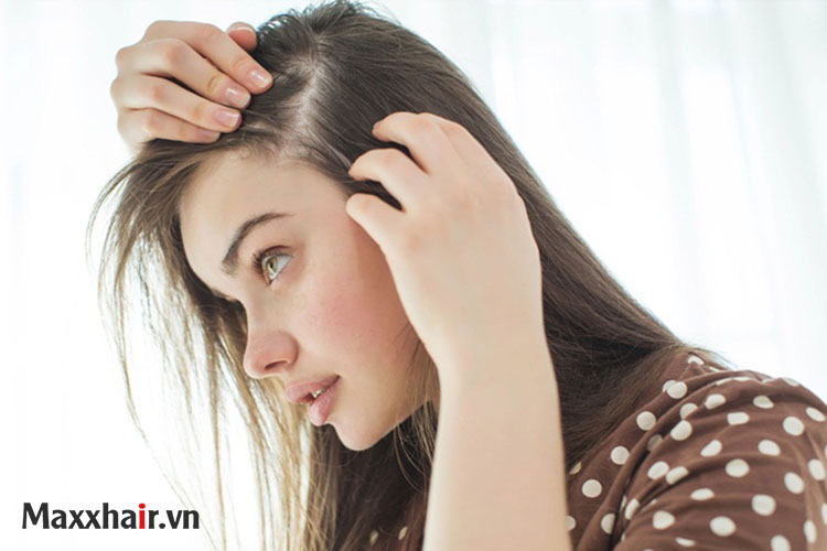 Rụng tóc nữ - nguyên nhân do đâu? 1 Rụng tóc nữ - nguyên nhân do đâu? 1