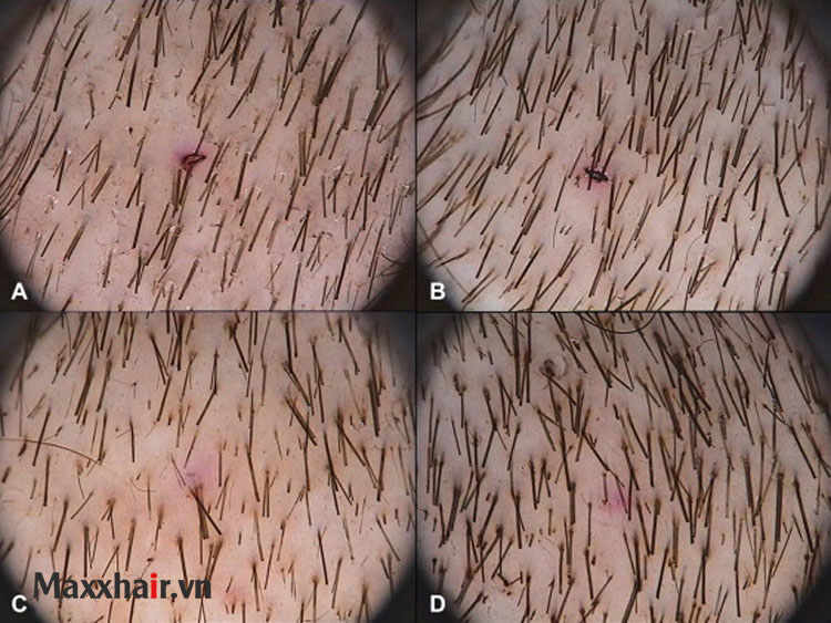 4. Chụp ảnh quang phổ 1 4. Chụp ảnh quang phổ 1