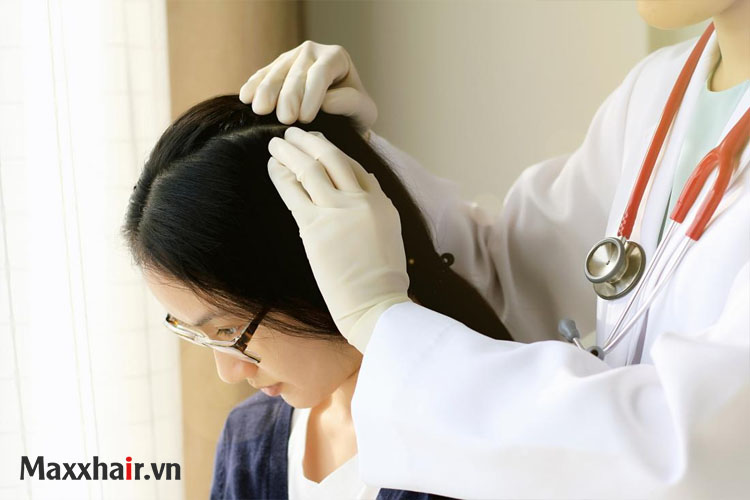 Rụng tóc khi nào nên đi khám bác sĩ? 1 Rụng tóc khi nào nên đi khám bác sĩ? 1