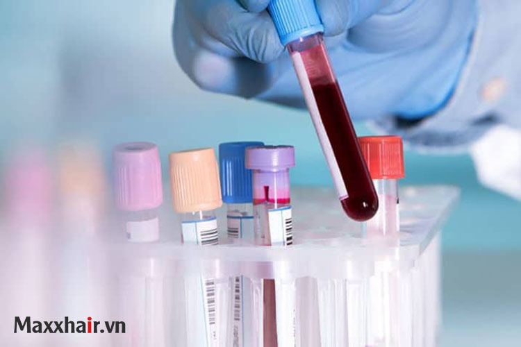 3. Nghiên cứu các mẫu xét nghiệm của tóc 1 3. Nghiên cứu các mẫu xét nghiệm của tóc 1