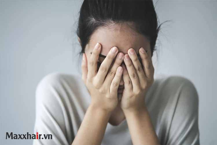 Nguyên nhân gây hói đầu 1 Nguyên nhân gây hói đầu 1