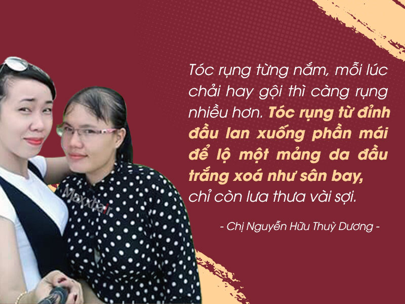 Tóc rụng nhiều sau sinh đến trơ da đầu và hành trình tìm lại “mái tóc thanh xuân” 3 Tóc rụng nhiều sau sinh đến trơ da đầu và hành trình tìm lại “mái tóc thanh xuân” 3