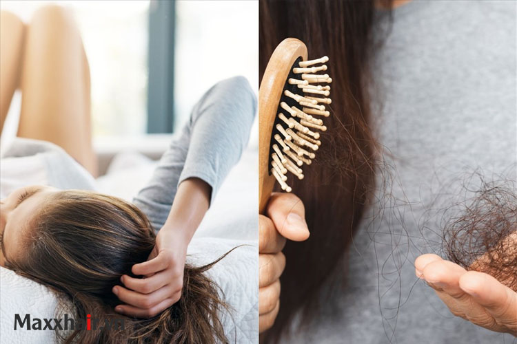 1. Nguyên nhân gây rụng tóc sau khi ngủ dậy 1 1. Nguyên nhân gây rụng tóc sau khi ngủ dậy 1