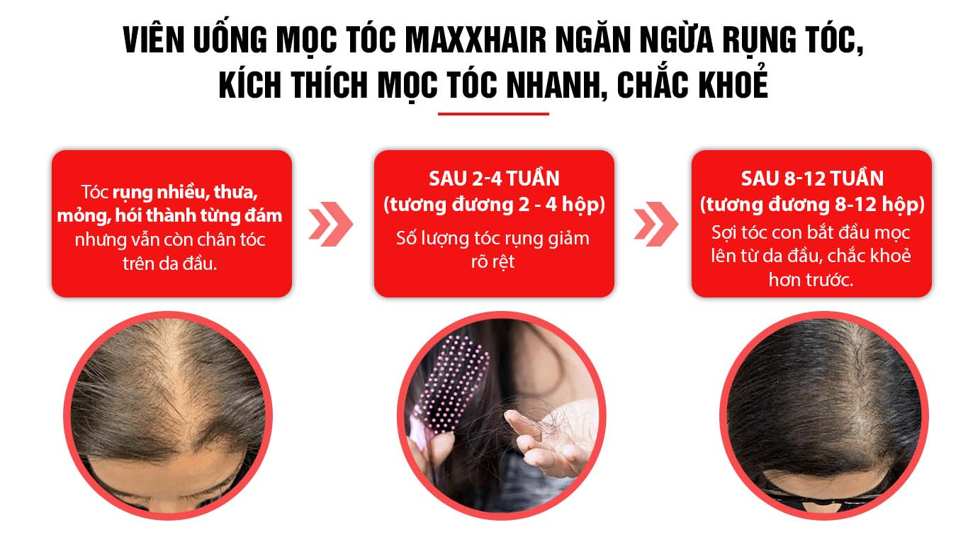 Liệu trình sử dụng Maxxhair hiệu quả 1 Liệu trình sử dụng Maxxhair hiệu quả 1