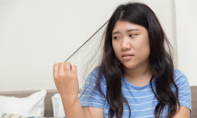 Nghiện giật tóc gây ra nhiều ảnh hưởng tiêu cực tới cuộc sống Nghiện giật tóc gây ra nhiều ảnh hưởng tiêu cực tới cuộc sống