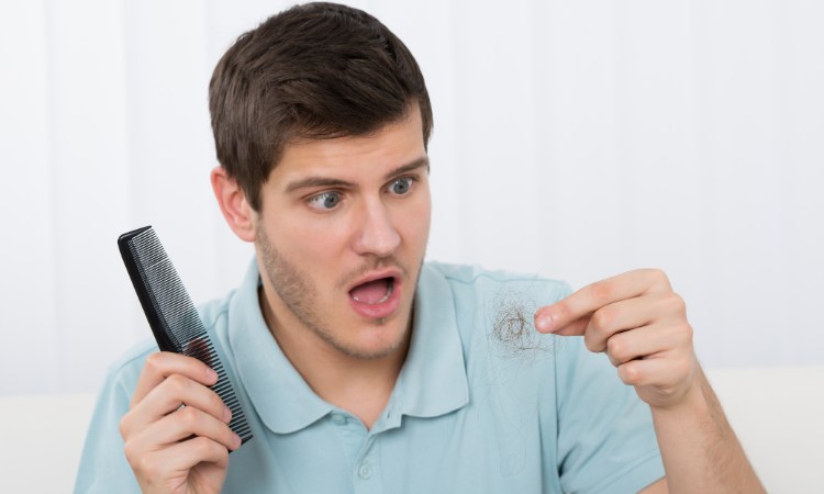 Rụng tóc hói đầu đang có xu hướng trẻ hóa Rụng tóc hói đầu đang có xu hướng trẻ hóa