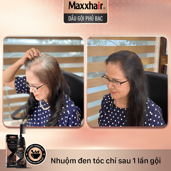 Khách hàng đã gội nhuộm đen tóc từ Dầu gội phủ bạc Maxxhair 3 Khách hàng đã gội nhuộm đen tóc từ Dầu gội phủ bạc Maxxhair 3