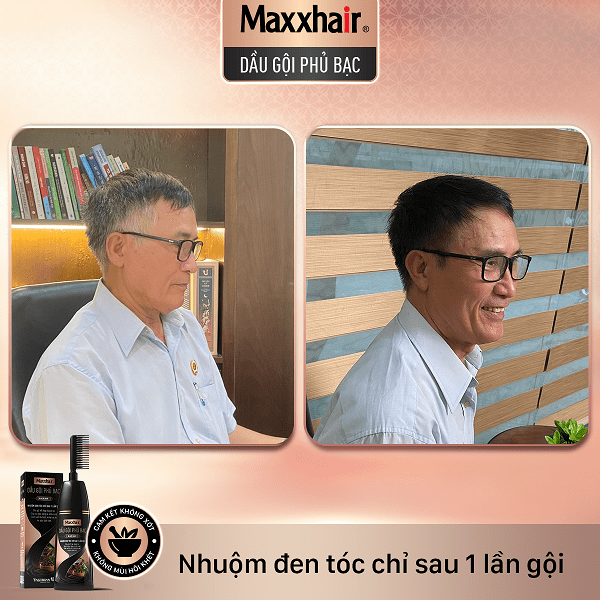 Khách hàng đã gội nhuộm đen tóc từ Dầu gội phủ bạc Maxxhair 2 Khách hàng đã gội nhuộm đen tóc từ Dầu gội phủ bạc Maxxhair 2