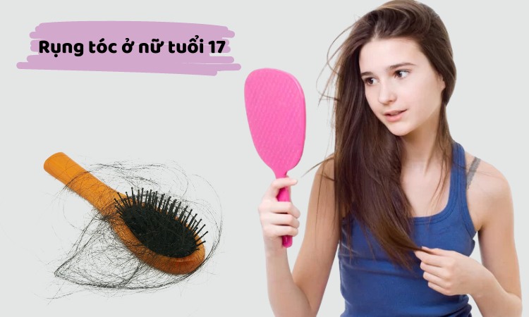 Rụng tóc ở nữ tuổi 17 là hiện tượng không phổ biến